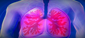 Artigo sobre “Improving lung health in low-income and middle-income countries”